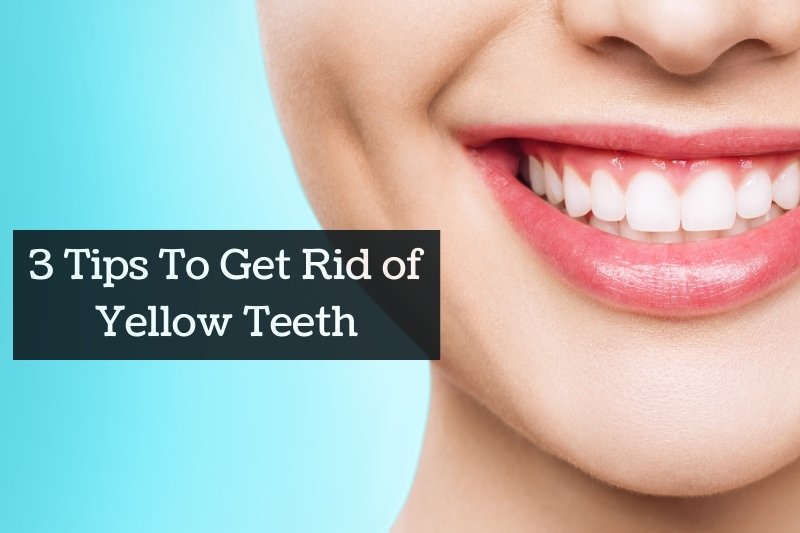 Tips To Get Rid of Yellow Teeth